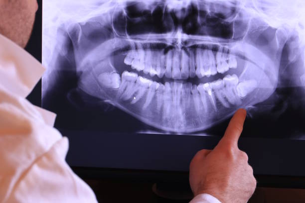 Best Broken or Chipped Tooth Repair in Spiro, OK