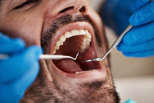 Best Emergency Denture Repair in Spiro, OK